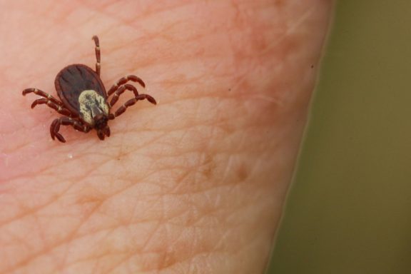 A tick on a person's skin.